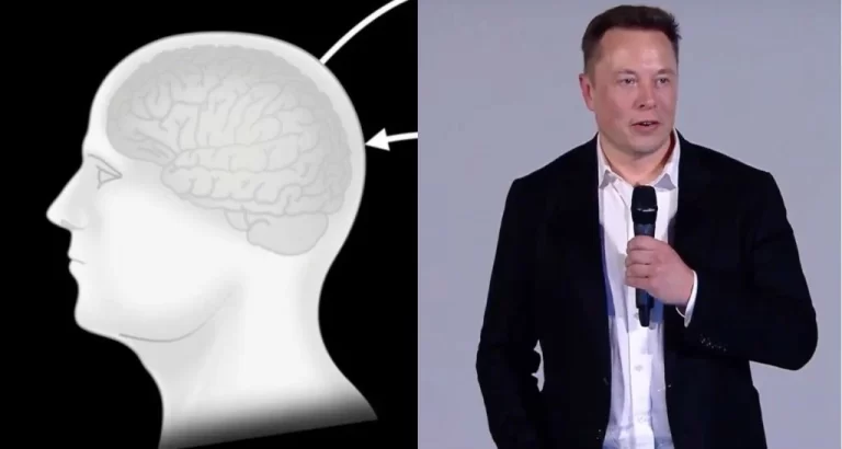 Elon Musk Announced Successful Implantation of Neuralink’s Brain Interface in Its First Human Recipient