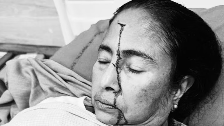 Photo of injured mamata banerjee
